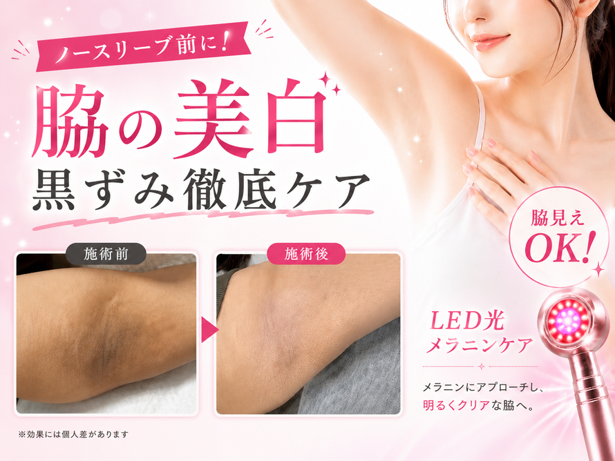 札幌|脇の黒ずみ改善|脇の美白|LED光メラニンケア|脇見えに自信｜明るくクリアな脇へ|エステサロン Twinkle(トゥインクル)