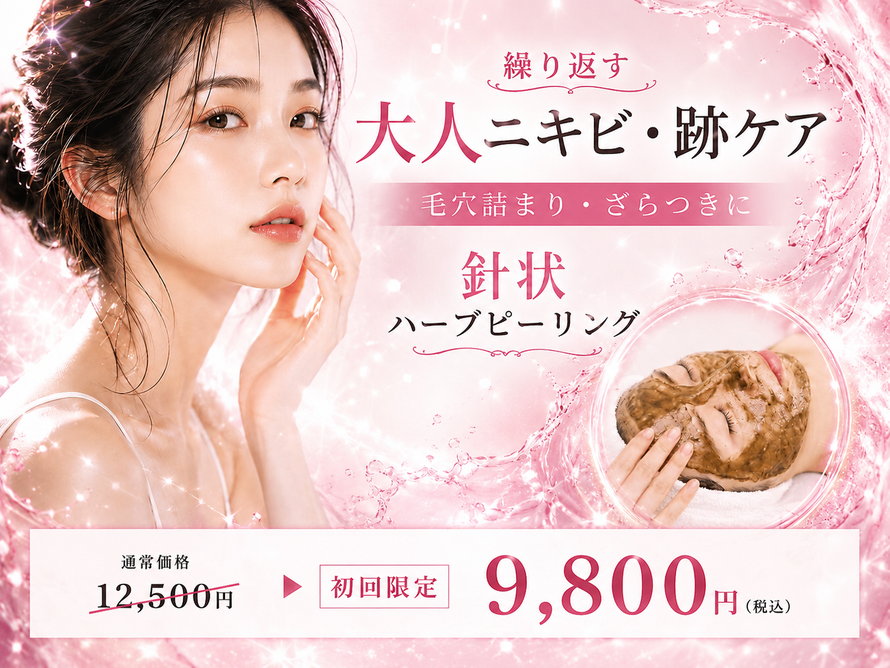 札幌|繰り返す大人ニキビ・ニキビ跡を改善|針状ハーブピーリング|エステサロン Twinkle(トゥインクル) 