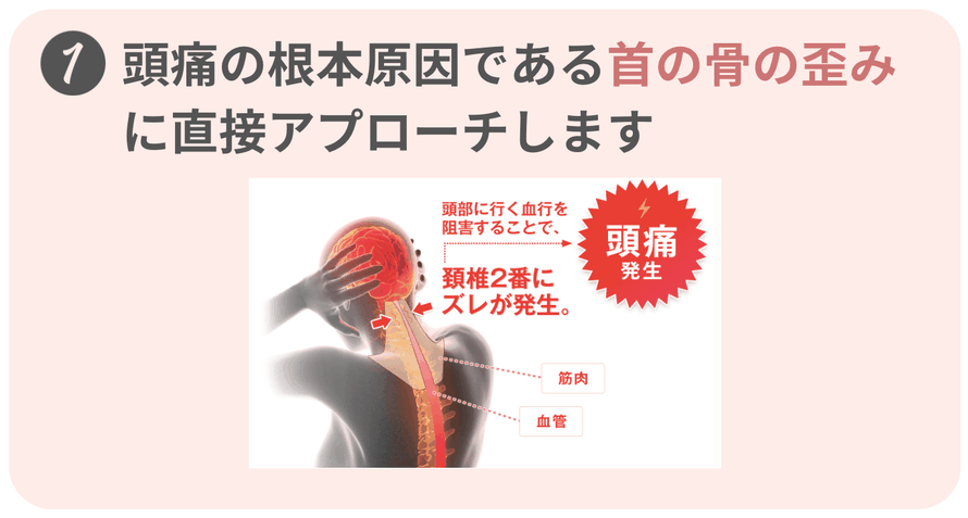 神経整体、自律神経、感覚神経、頭痛の原因、頭痛、頭痛治し方、偏頭痛、緊張型頭痛、群発頭痛、