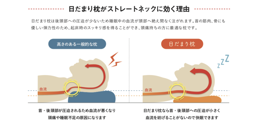 日だまり枕がストレートネックに効く理由