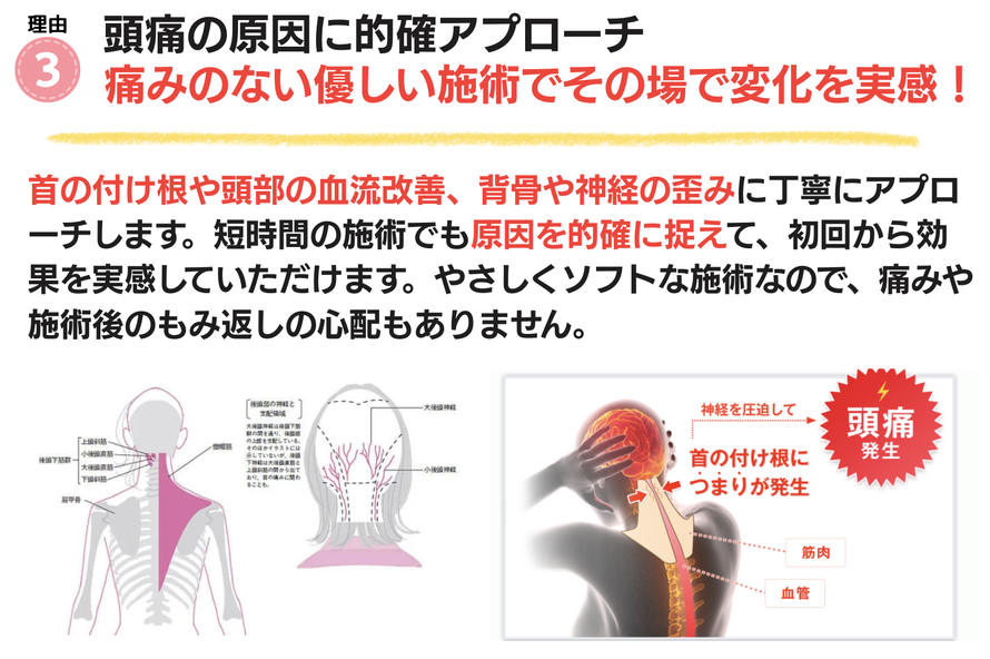 頭痛原因に優しく的確にアプローチする施術