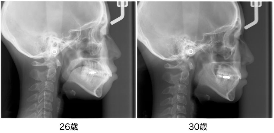 Radiographic Cephalometry   歯科　本　矯正