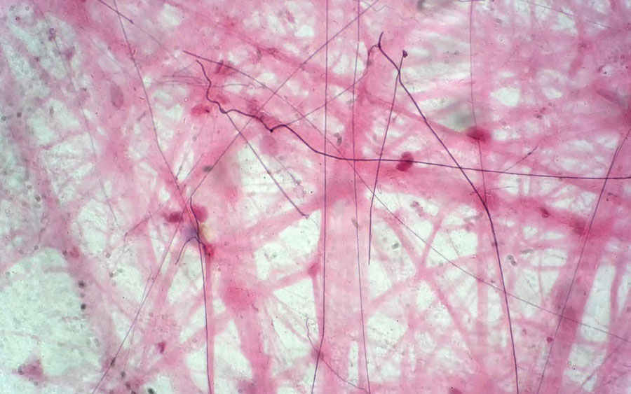 Lockeres Bindegewebe wie es unter dem Mikroskop aussieht