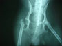 犬の大腿骨頭切除術②                                 富山市　関動物病院
