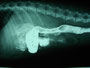 バリウムを飲ませて24時間後、胃の中のバリウムの染みたタオルの繊維が見えてきました。