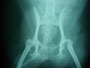 犬の大腿骨頭切除術①　入院は、3日間。退院後は普通に歩かせてください。10日後抜糸します。抜糸後は砂利道を走らせてください。