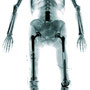 assemblage I | x-ray photograph | digital development | digital print | 180 x 80 cm 