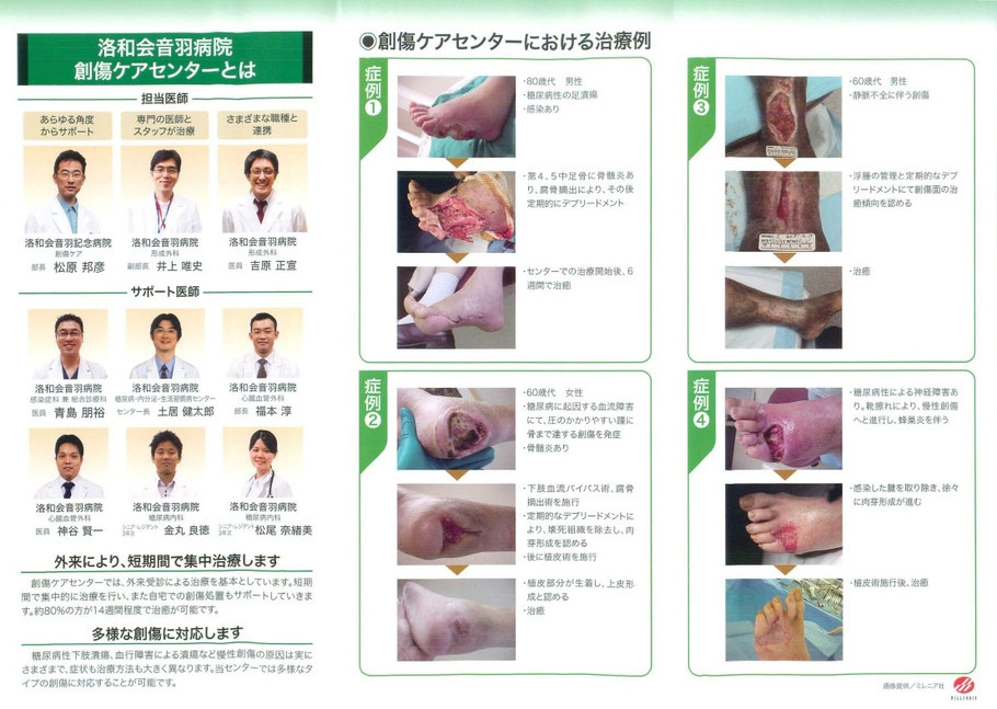 糖尿病 洛和会創傷ケアセンター 糖尿病 足 治療装具のページ