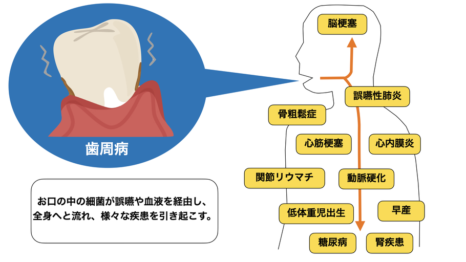 全身疾患