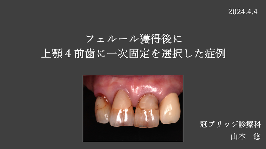 矯正ループ歯科