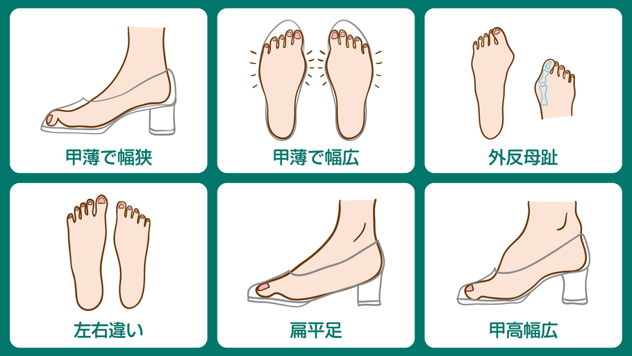 甲薄で幅狭・甲薄で幅広・外反母趾・左右違い・扁平足・甲高幅広