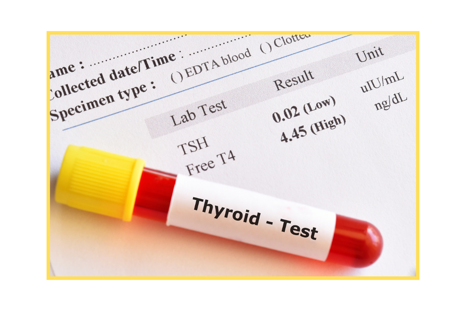 Ein Röhrchen einer Blutbrobe die auf einem Befund liegt auf dem steht "Thyroid Test"