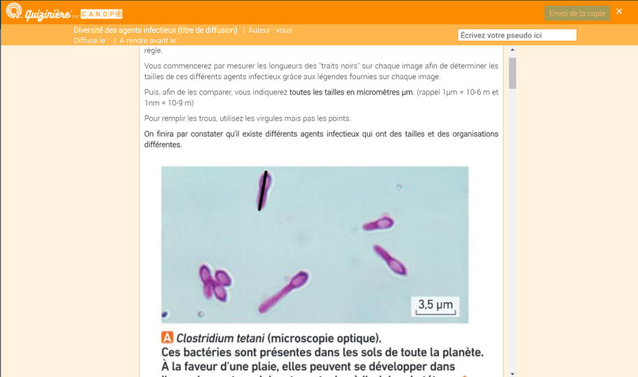 Chapitre 2 : Agents pathogènes et maladies infectieuses - SVT cours et ...