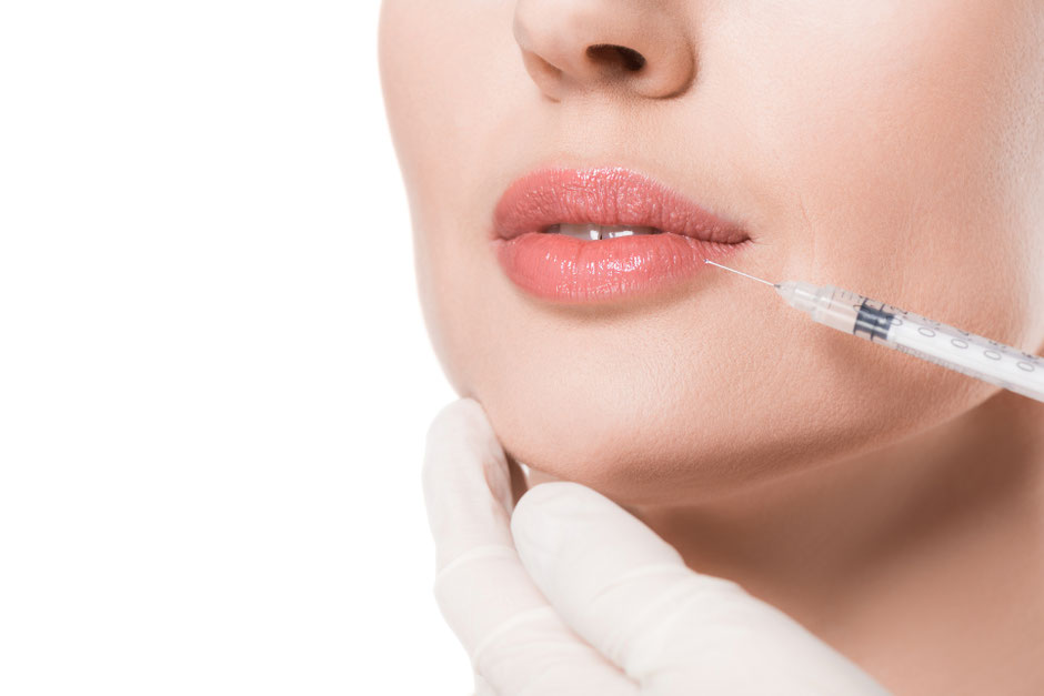 Lippenunterspritzung - Warum Praxis Wältz in Ihrer Nähe?