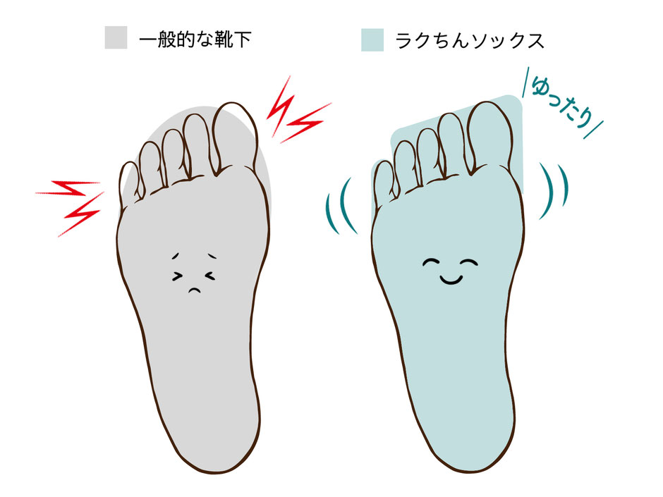 外反母趾にお勧めの靴下