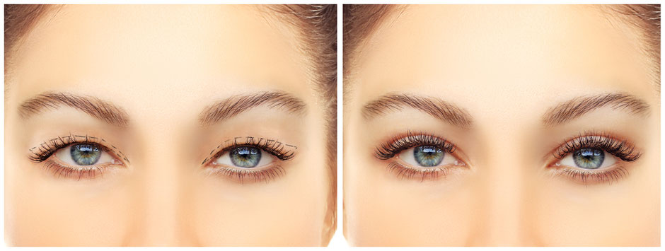 plasmalifting ohne op, lidstraffung ohne op,