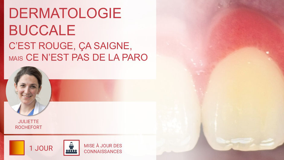 ParoSphère Formation | Journée dermatologie buccale
