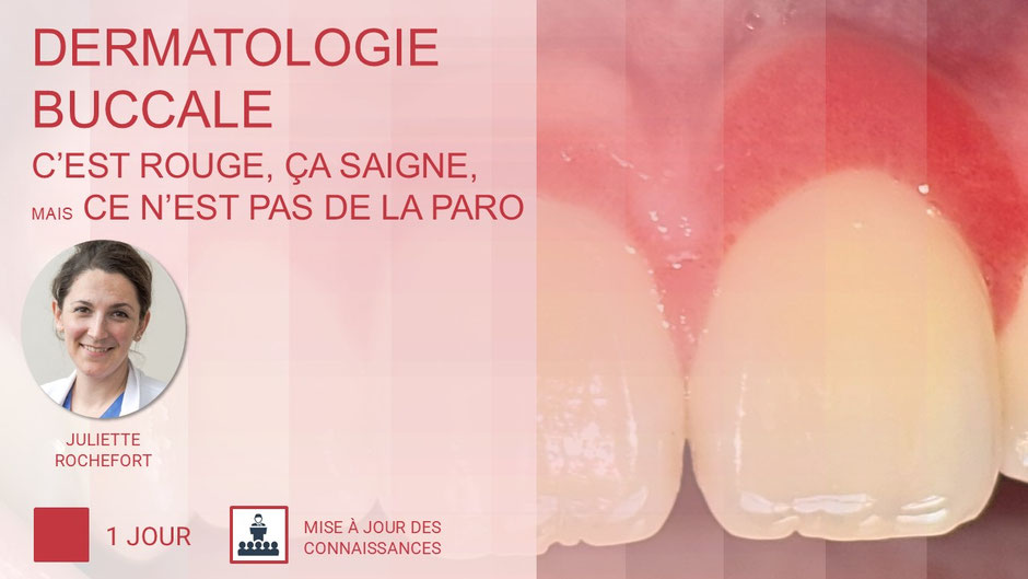 ParoSphère Formation | Journée dermatologie buccale