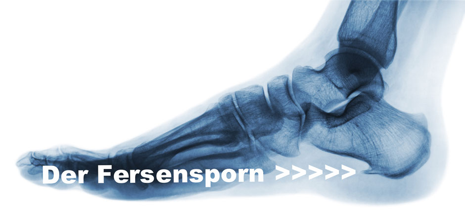 Fersensporn / Fersenspor