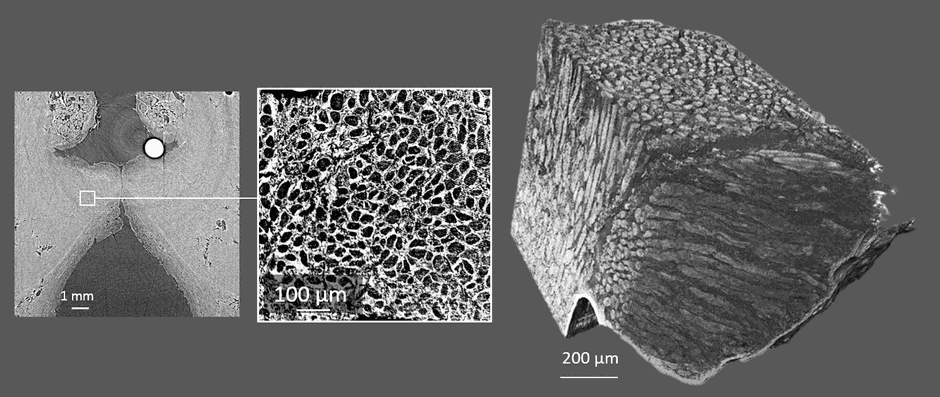 Multiscale X-ray tomographic images of a human vocal fold. Left: global view. Center: detail of the tissue. Right: 3D reconstruction of the network of muscular, collagen and elastic fibres (adapted from Bailly et al., in Scientific Reports, 2018)