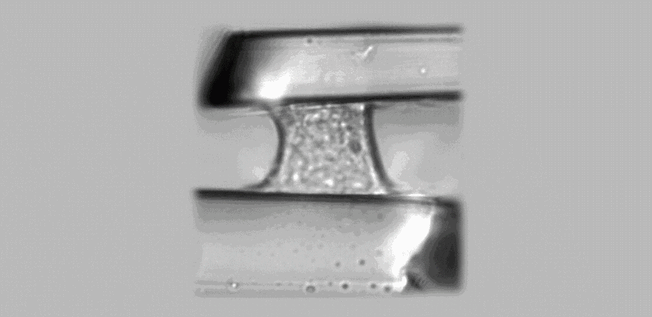 Image : Vue en microscopie optique d’une cellule isolée soumise à une force de traction verticale entre deux plaques parallèles. La plaque supérieure sert de nano dynamomètre pour mesurer la réponse cellulaire à la force exercée (Photo MSC, Paris Diderot)