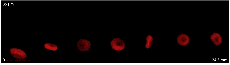 Image adapted from Losserand et al., in Microvascular Research, 2019