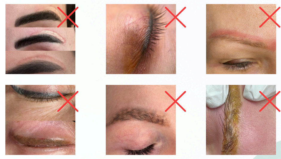 corso remover 