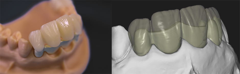 twoinone dental fräszentrum zahntechnik peek