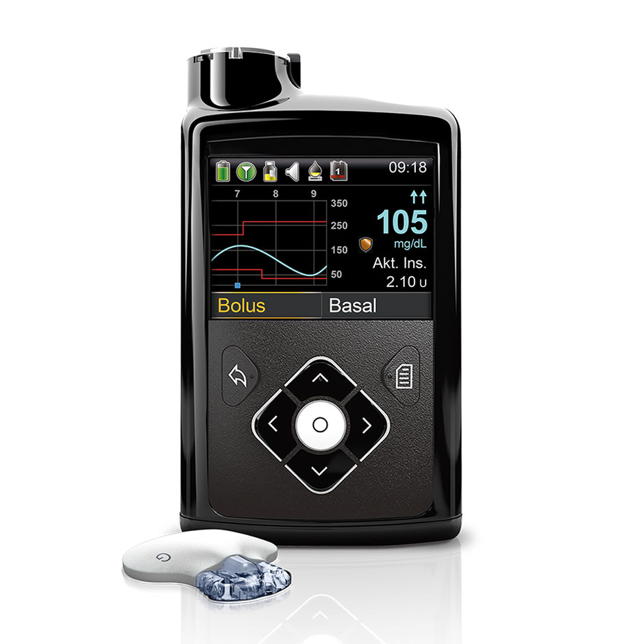 Für die CGM gesteuerte Insulinpumpentherapie gut Pumpen