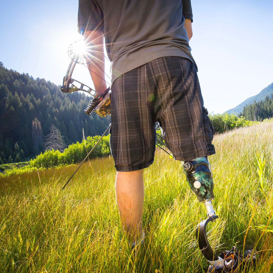 A day skipped at work, a mutilated snowboarding boot and the invention of the adjustable socket (picture courtesy of Click Medical).