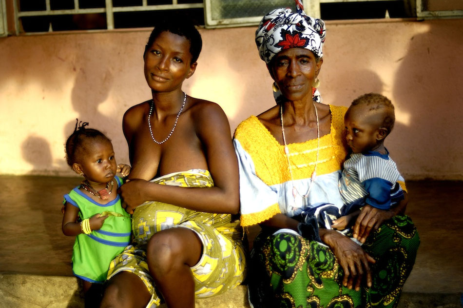 Sierra Leone Unicef malnutrition   © François Struzik - simply human