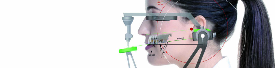 トーシンデンタル　ジルコンザーン　プレーンファインダー　フェイスハンター　プレーンシステム　ナチュラルヘッドポジション（ＮＨＰ）