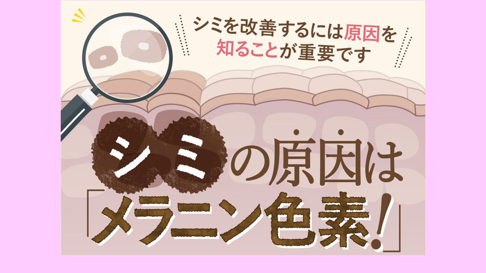 シミを改善するには原因を知ることが重要です。シミの原因はメラニン色素