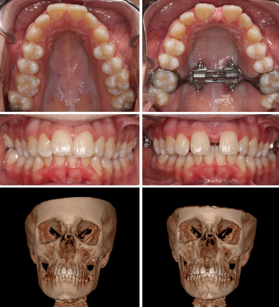 Formation au MSE Laboratoires d'orthodontie ODF Formation