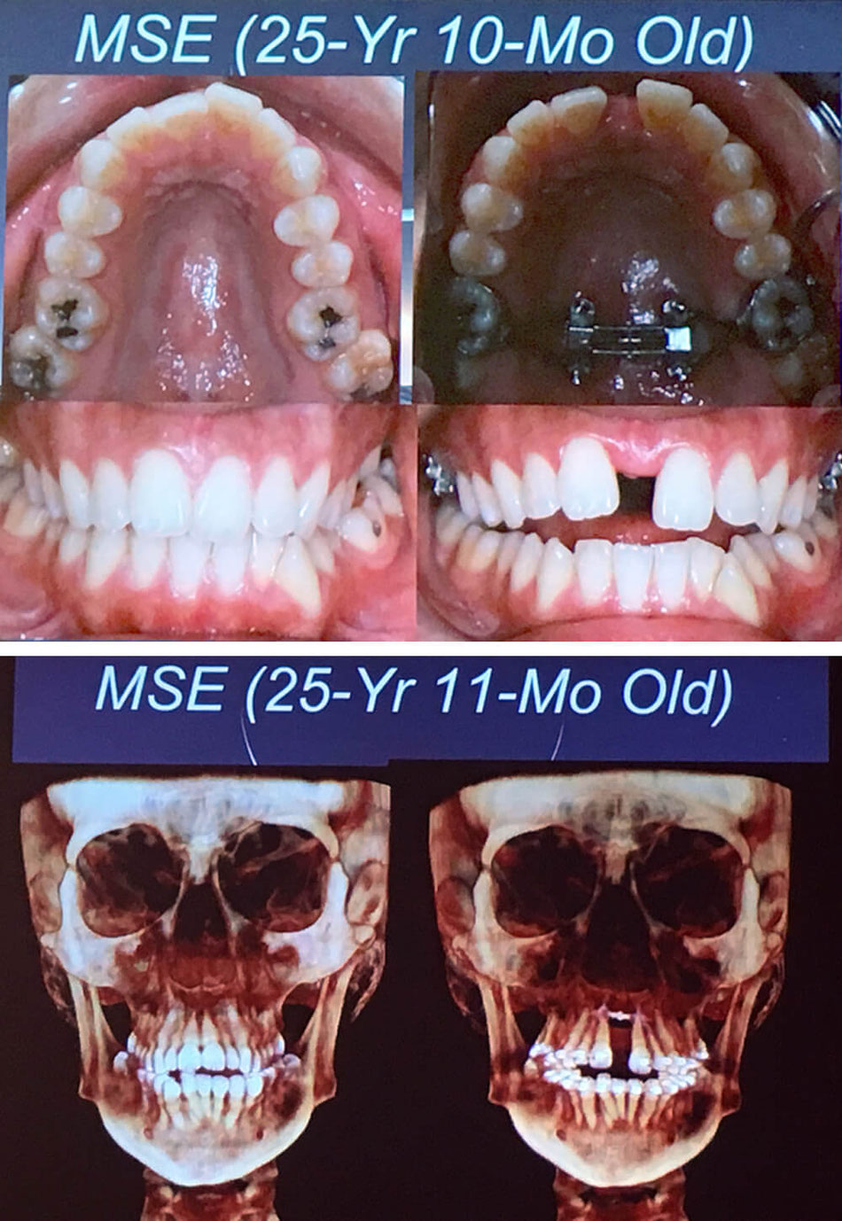 Formation au MSE Laboratoires d'orthodontie ODF Formation