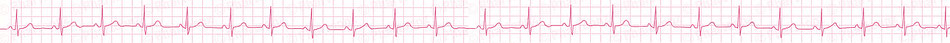 rythme, variation, courbe, cardiaque, indicateur, battement, repos, activité, accélération, intensité, réserve, capital