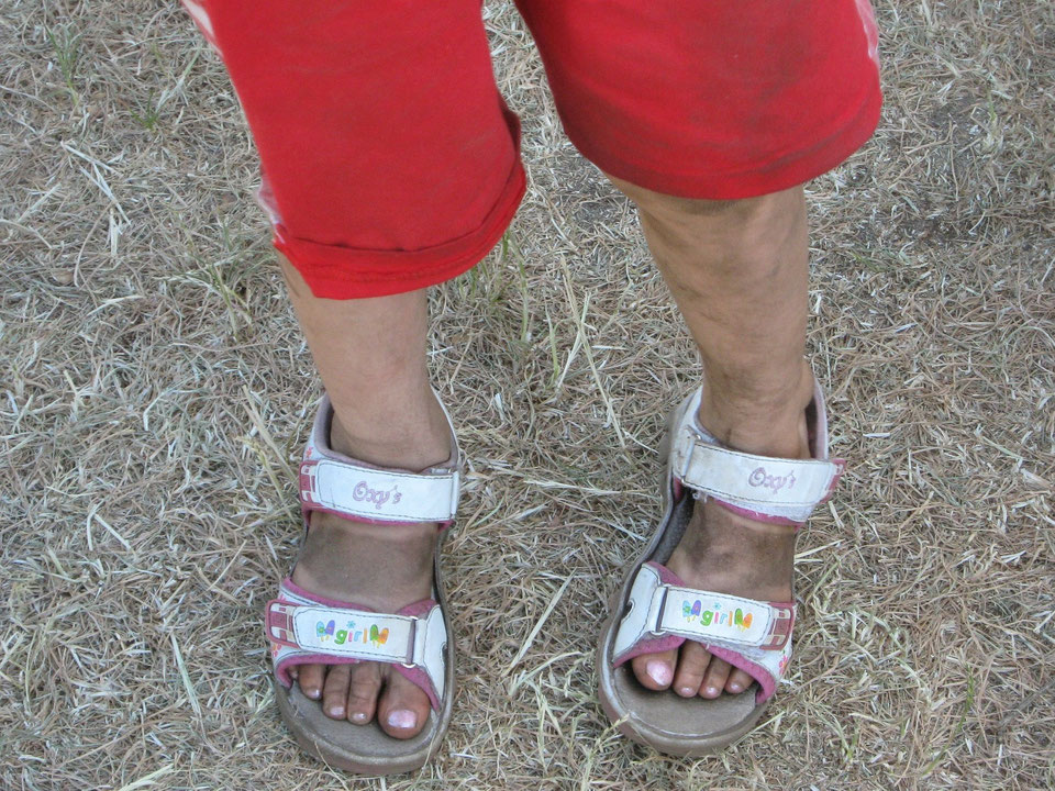 Mi niño "mete el pie" Intoeing Dra Rovira Página web de traumatologiayortopediapediatrica