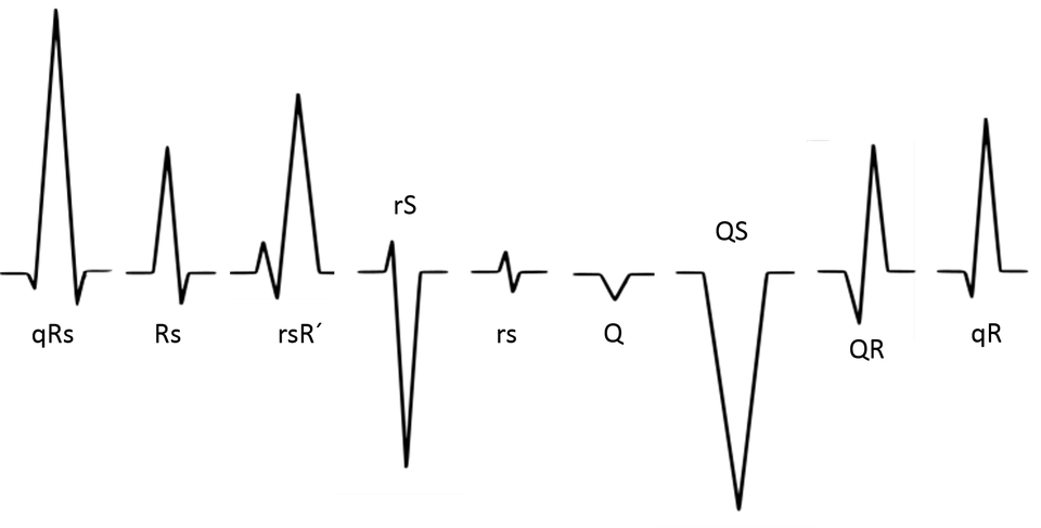 QRS-Komplex - Fokus-EKG