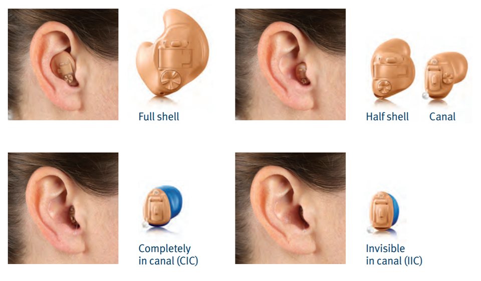 NHS vs. Private Hearing Aids Liverpool Hearing Centre