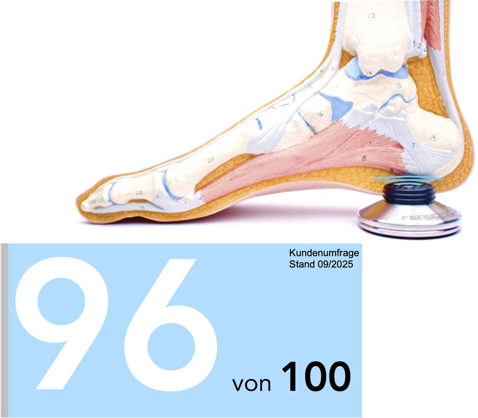 Fersensporn selbst behandeln