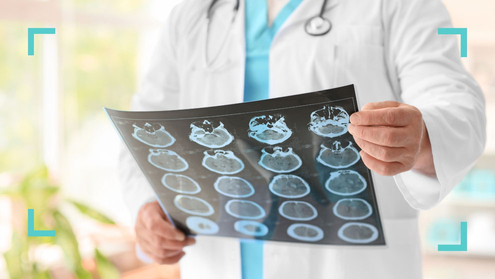 Arzt hält CT-Aufnahmen des Gehirns – neurologische Diagnostik in der Praxis Neuro im Zentrum St. Gallen