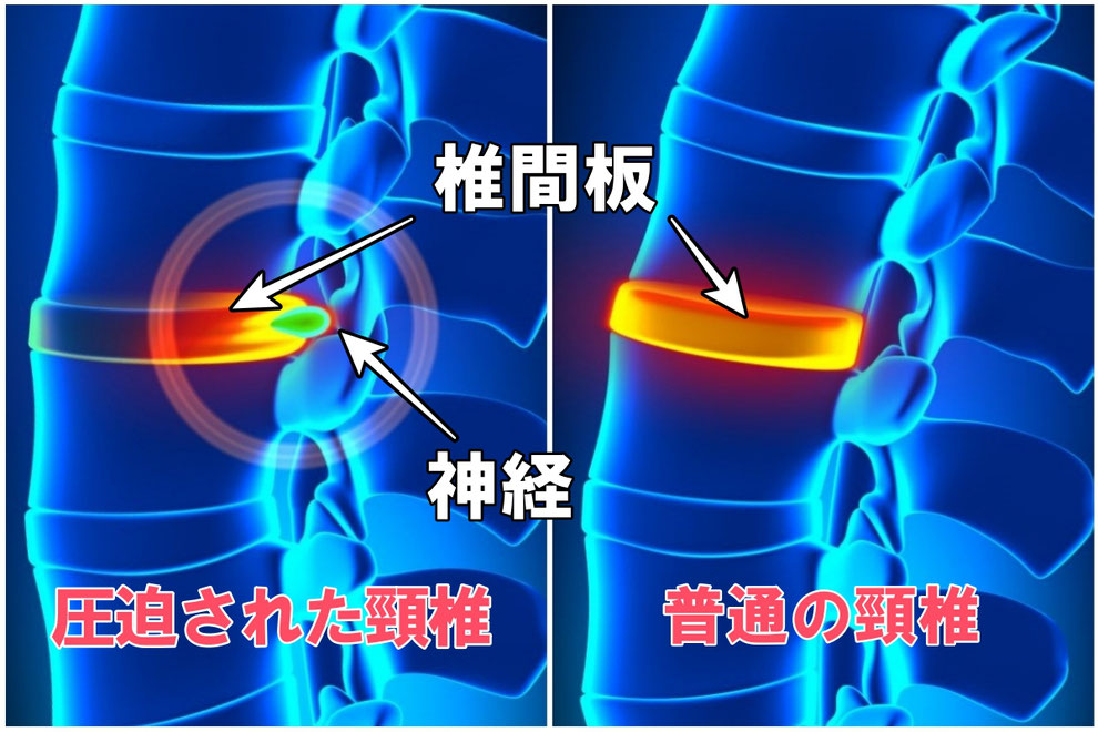 パーソナルトレーニング堺市