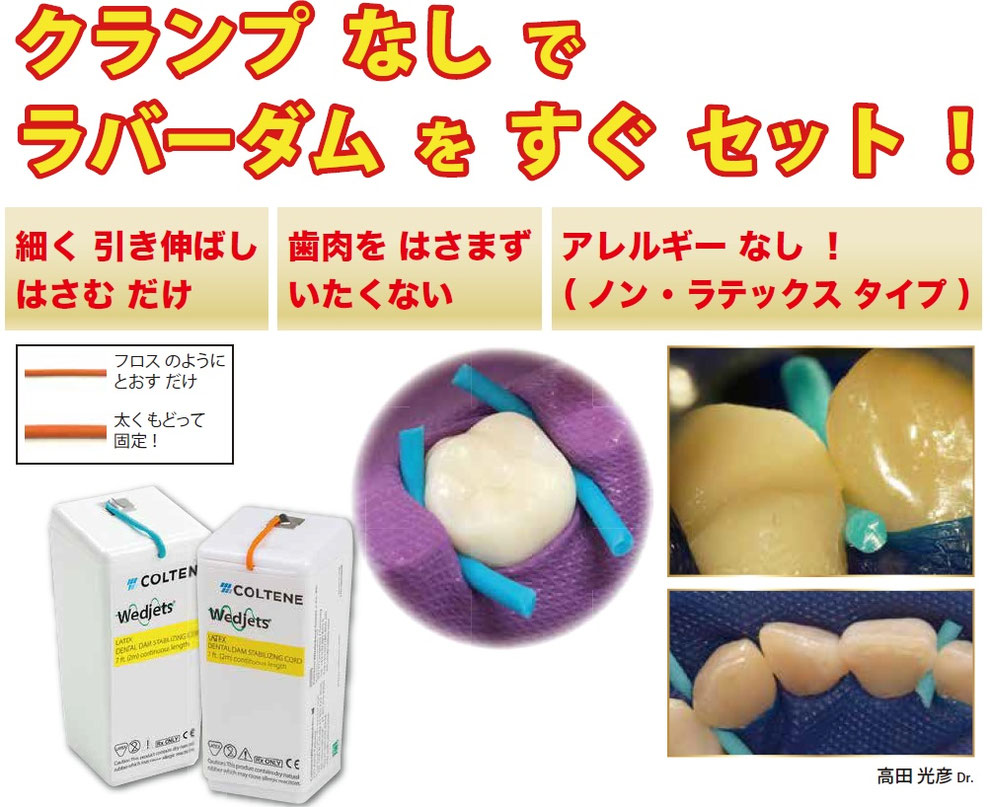 ハッピー岡田 様修理専用 RENOWNコスモAP シルエットフェンダー カッケ