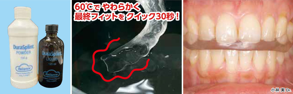 お湯でフィット スピーディ 超透明スプリント