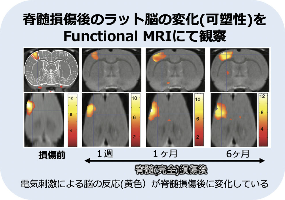 脊髄損傷後のラット脳の変化(可塑性）をFunctional MRIにて観察