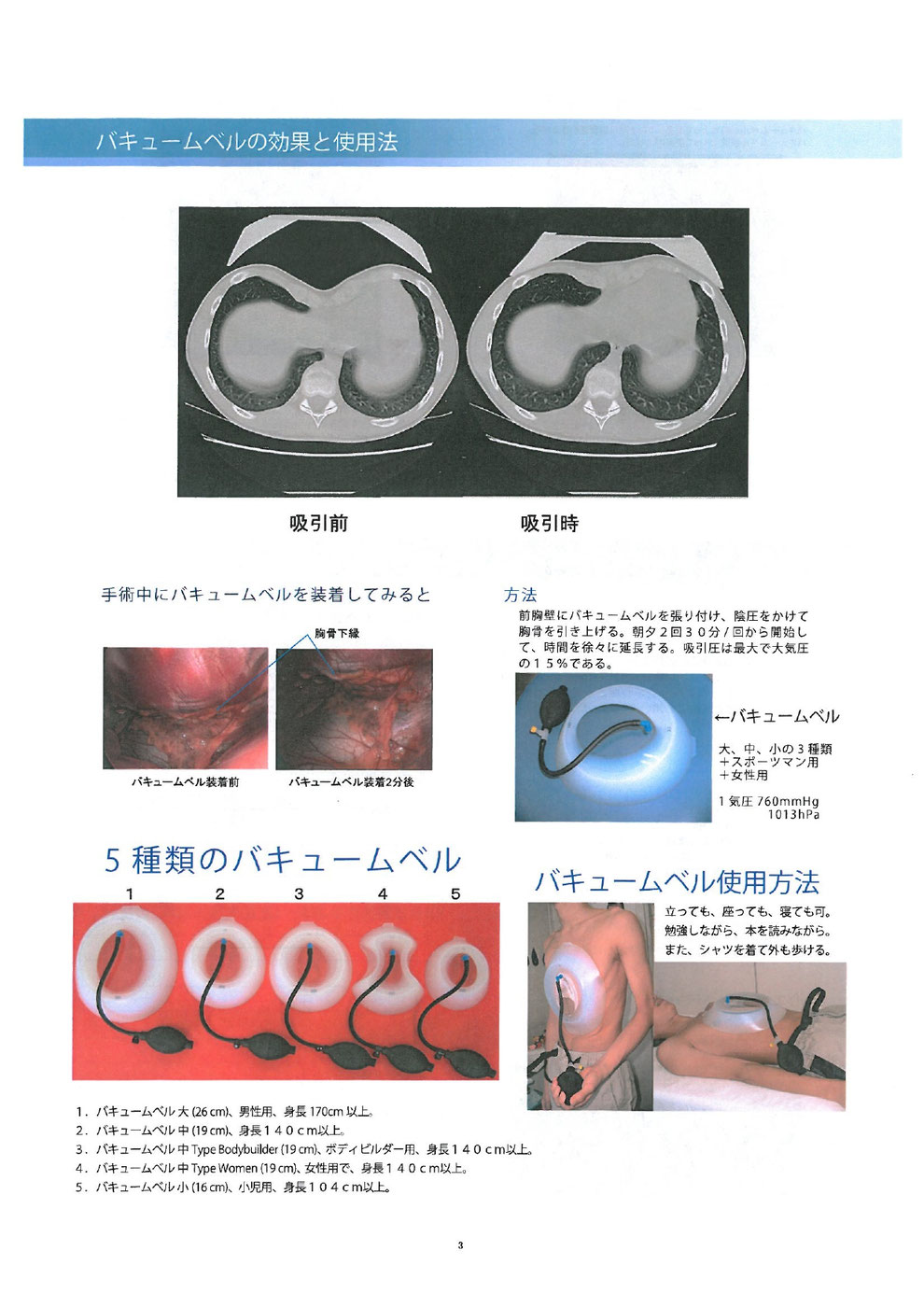 バキュームベル 漏斗胸