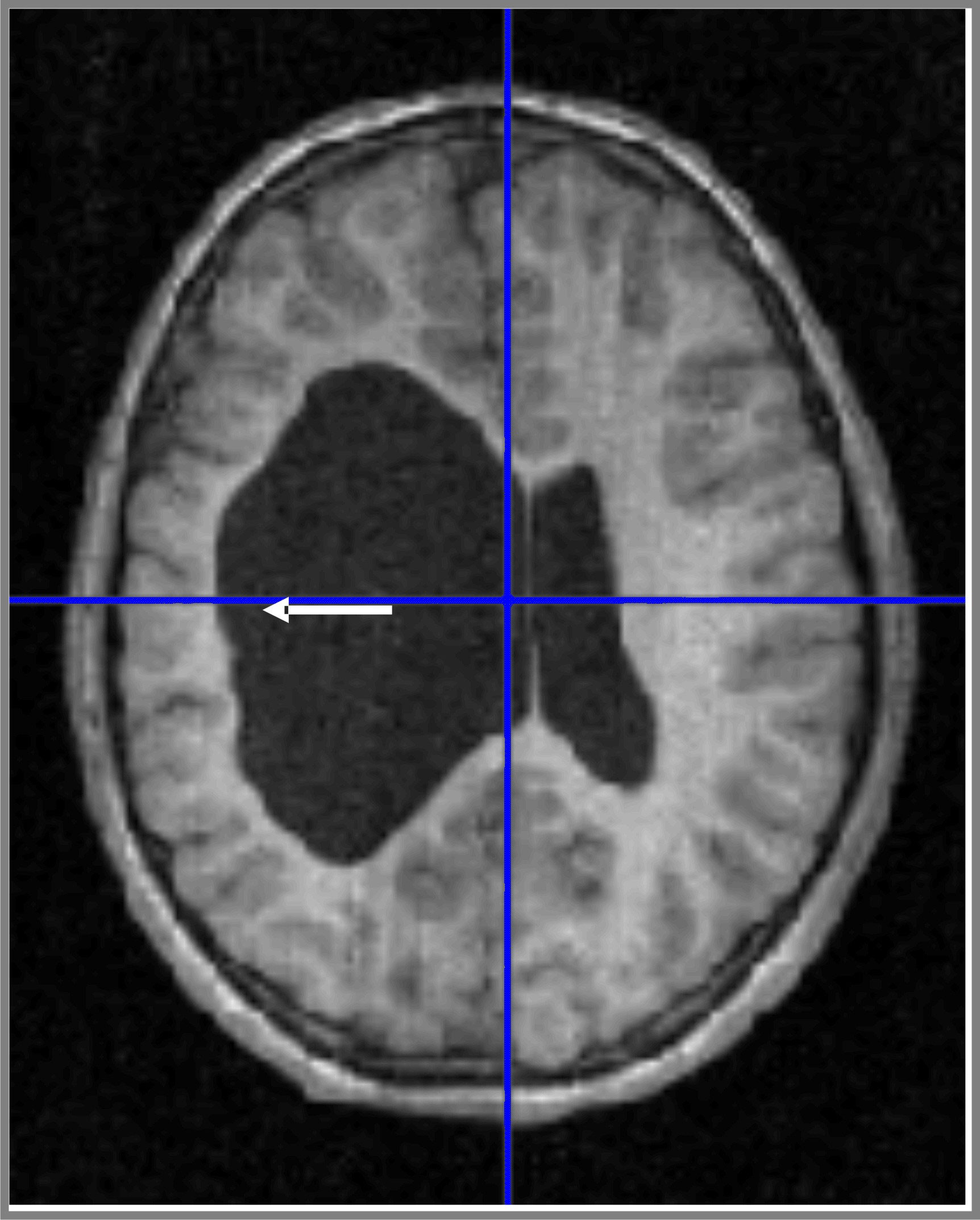 Die gespiegelte Sprache faktor14magazins Webseite!
