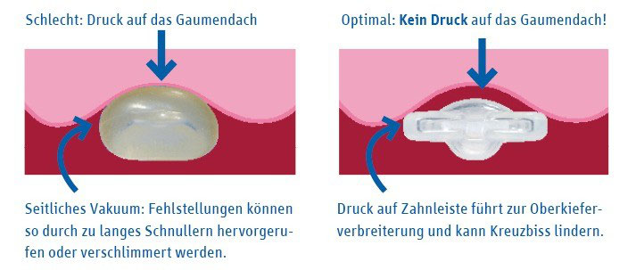 Der Richtige Schnuller Furs Baby Gesunde Kinderzahne Mit Prophylaxe