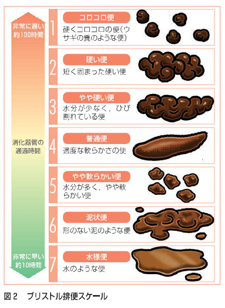 ブリストル便形状スケール 豊平区平岸の小児科 夜間診療は月 火 木 金の18時30分まで ブリストル便形状スケール 豊平区平岸の小児科 夜間診療は月 火 木 金の18時30分まで