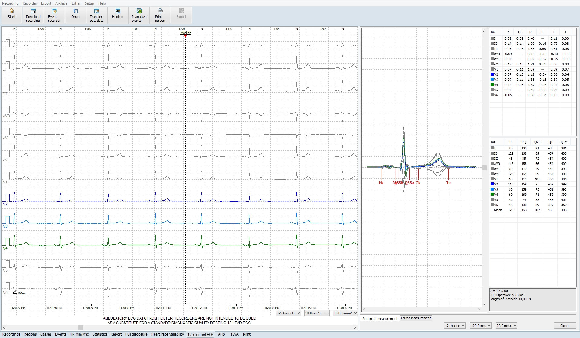 LangzeitEKG FokusEKG